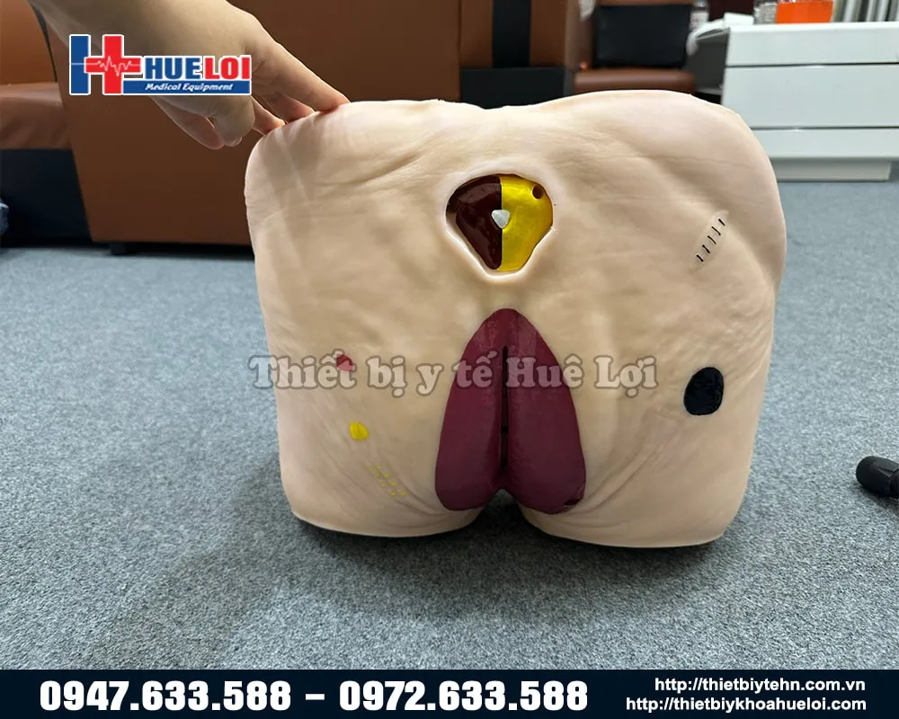 Mô hình chăm sóc vết thương cùng cụt