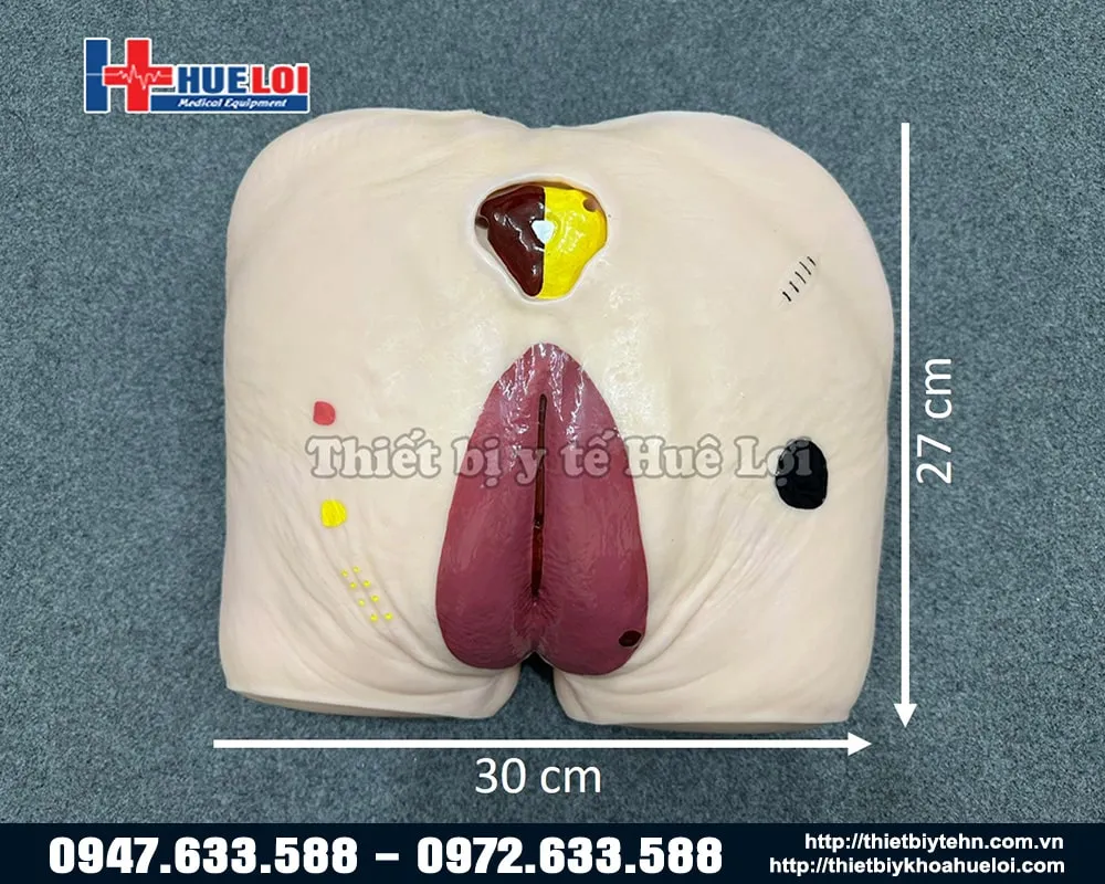 Kích thước tổng thể của cùng một vùng chăm sóc vết thương