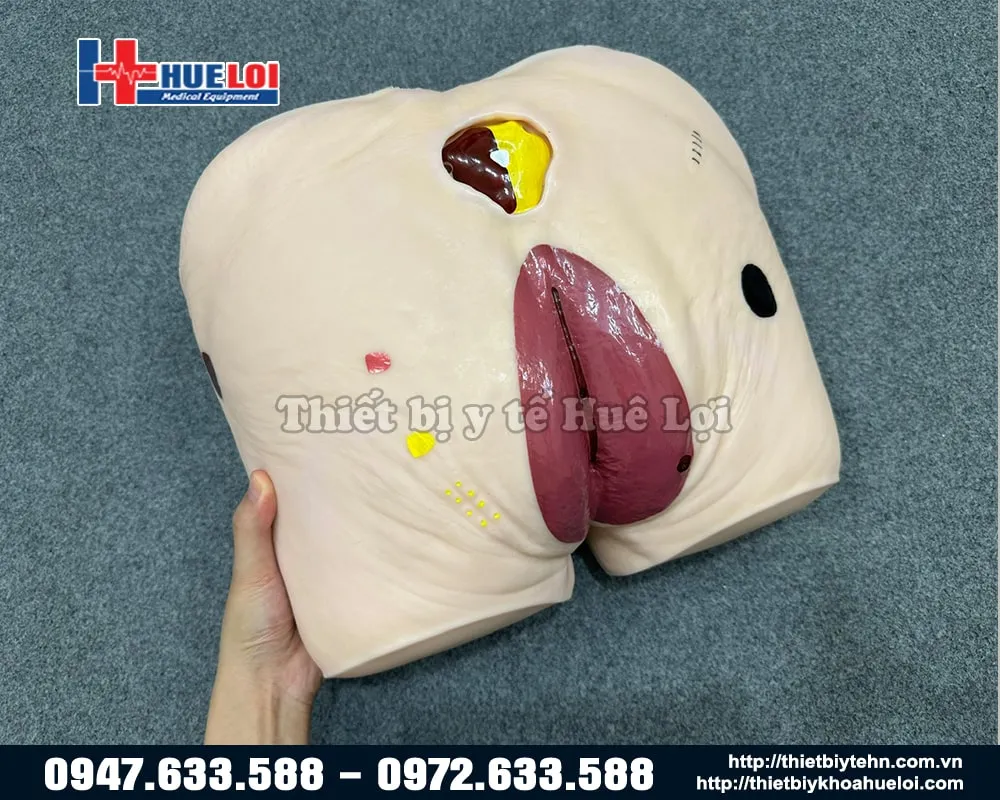 Tổng quan các vết thương của mô hình Chăm sóc vết thương