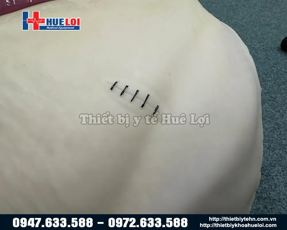 Vết thương chỉ khâu của mô chăm sóc vết thương