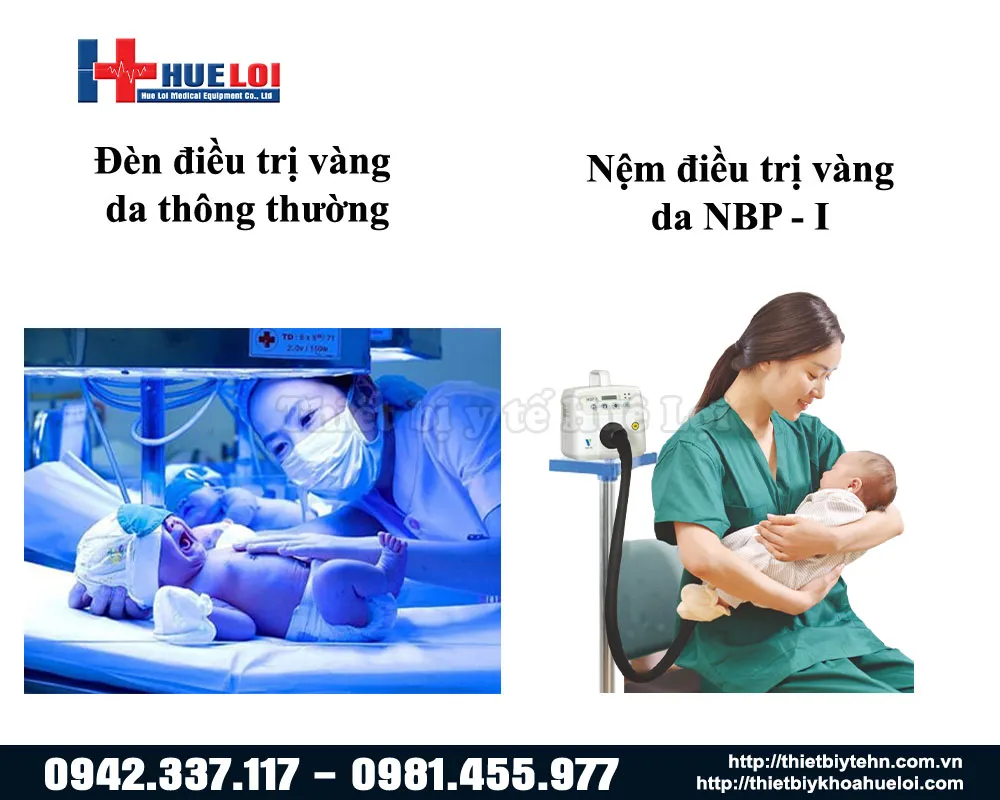 Sự khác nhau trong quá trình điều trị vàng da cho trẻ Sự khác nhau trong quá trình điều trị vàng da cho trẻ