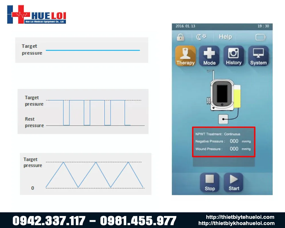 các chế độ của máy NP-800 các chế độ của máy NP-800