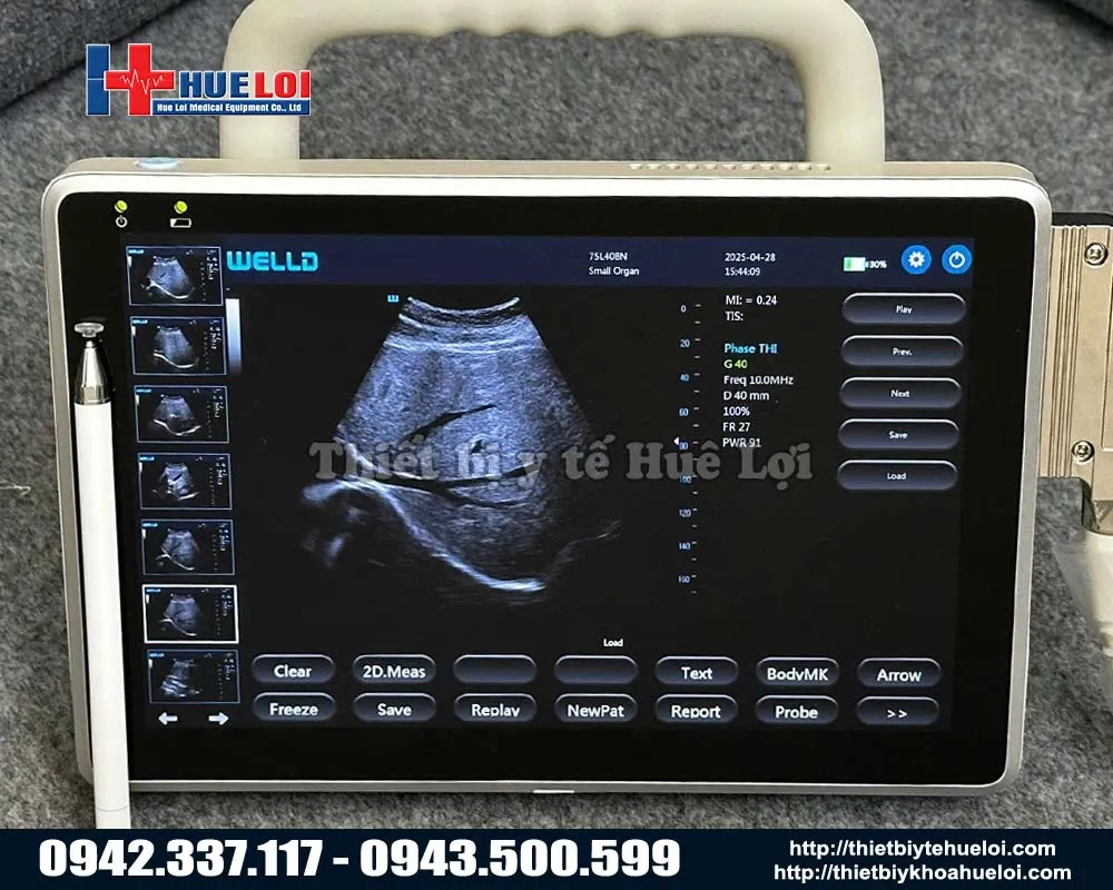 Máy siêu âm 2 đầu dò giá rẻ