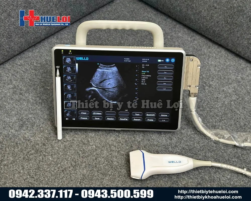 Máy siêu âm xách tay P10