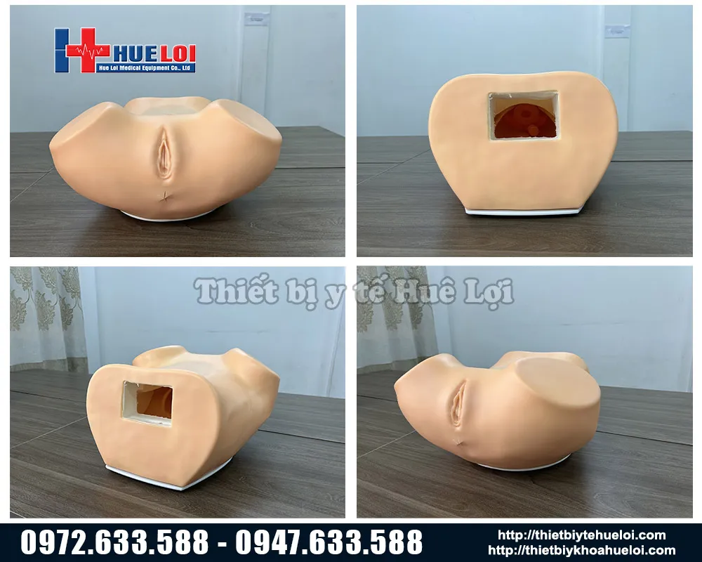 Tổng quan mô hình khám phụ khoa