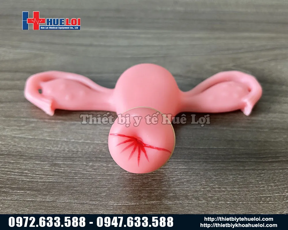 Phụ kiện của mô hình khám phụ khoa