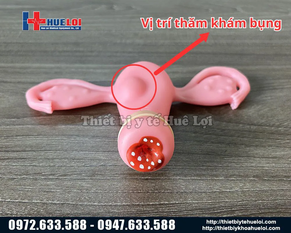 Phụ kiện mô hình khám tử cung bệnh lý