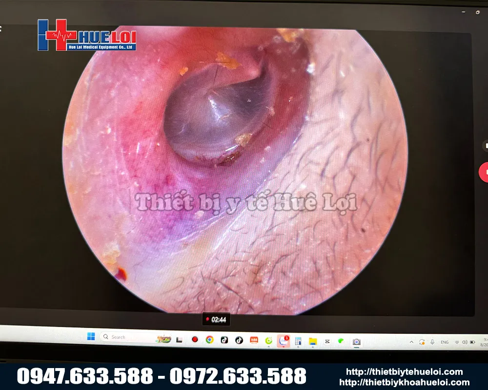 Chất lượng hình ảnh máy nội soi tai mũi họng mini