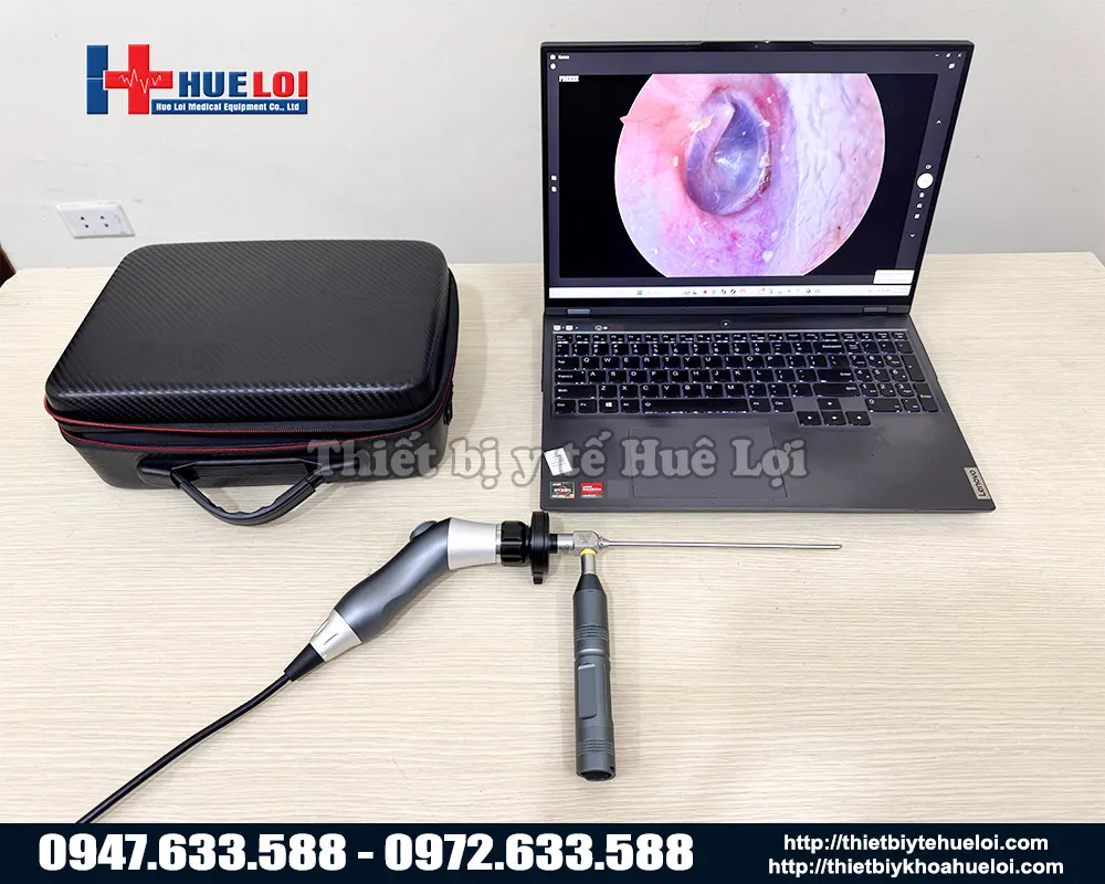 Máy nội soi tai mũi họng chất lượng tốt