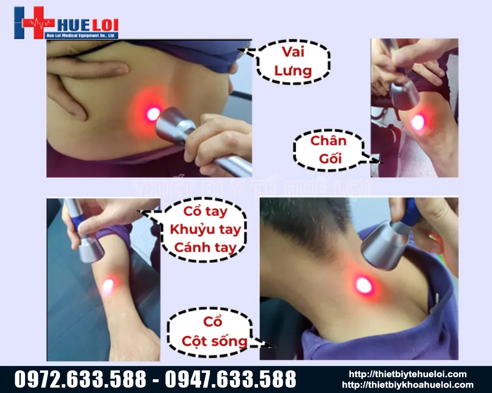 Vị trí điều trị của máy laser EC30