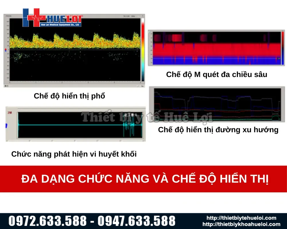 Các chế độ của máy siêu âm doppler xuyên sọ