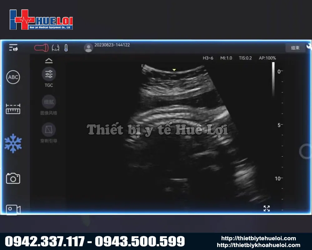 Hình ảnh của máy siêu âm di động