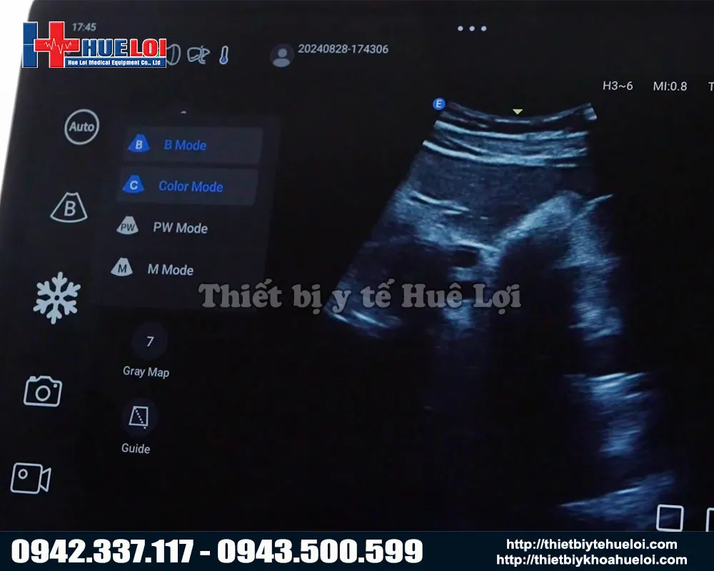 Các chế độ hình ảnh của máy siêu âm hình ảnh Edan L12