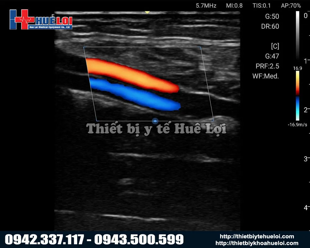 Hình ảnh của máy siêu âm di động Edan L12