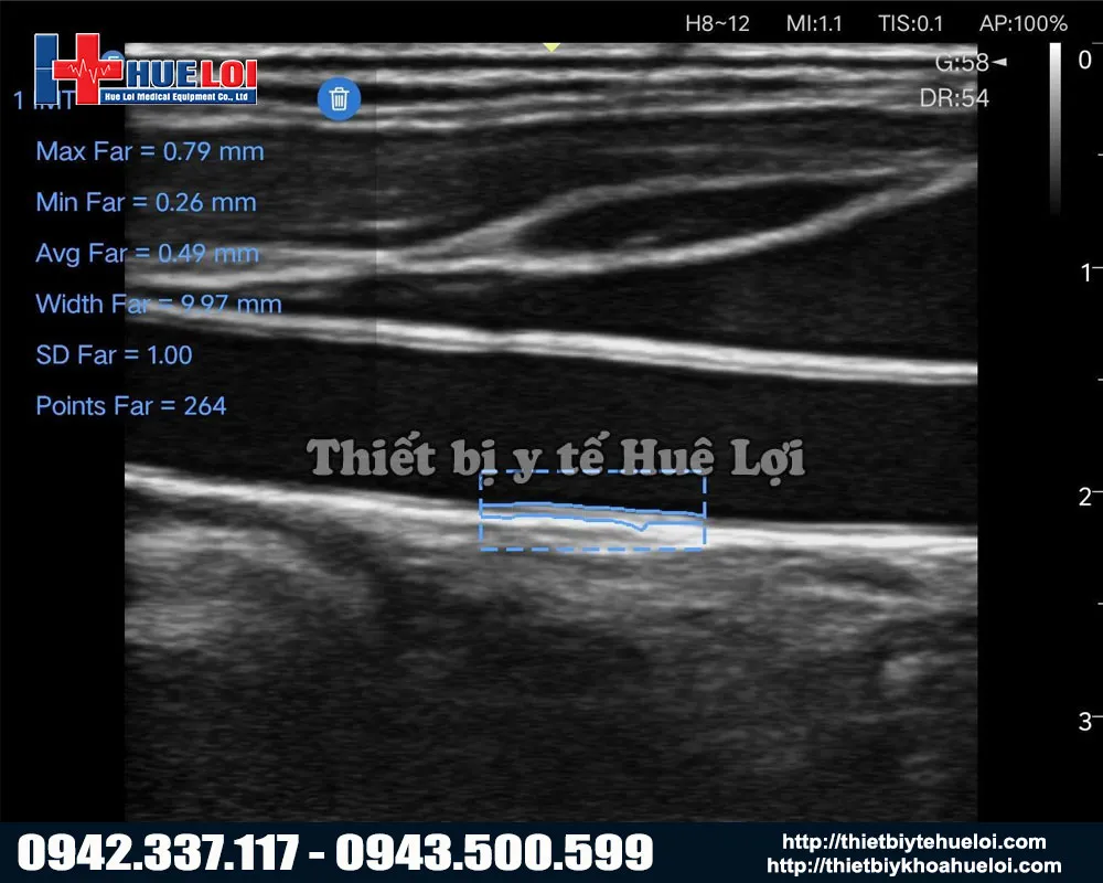 Hình ảnh của máy siêu âm di động