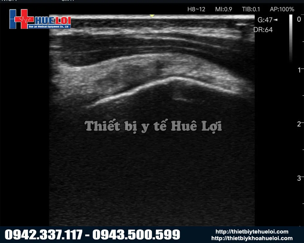 Hình ảnh của máy siêu âm di động Nano L12 Exp Edan