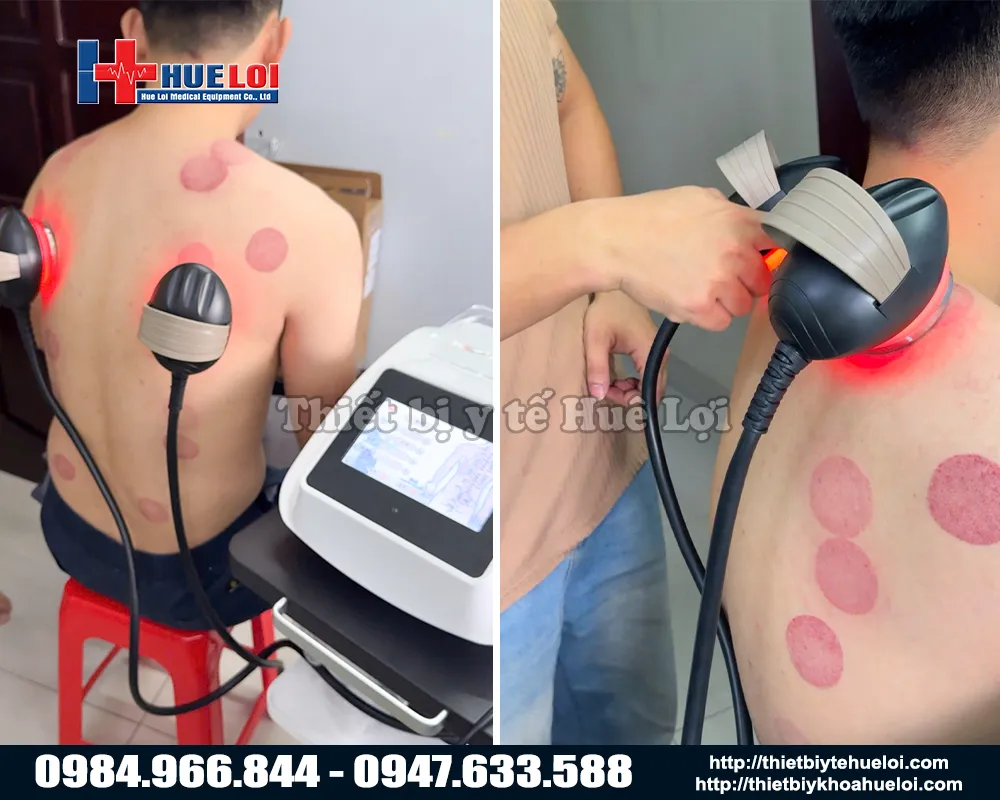 Trải nghiệm máy DDS thế hệ mới