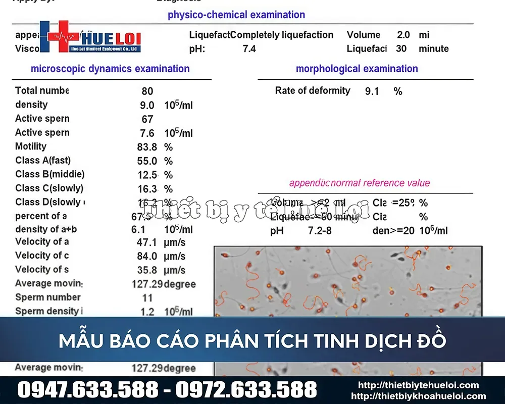 Kết quả báo cáo phân tích tinh dịch đồ
