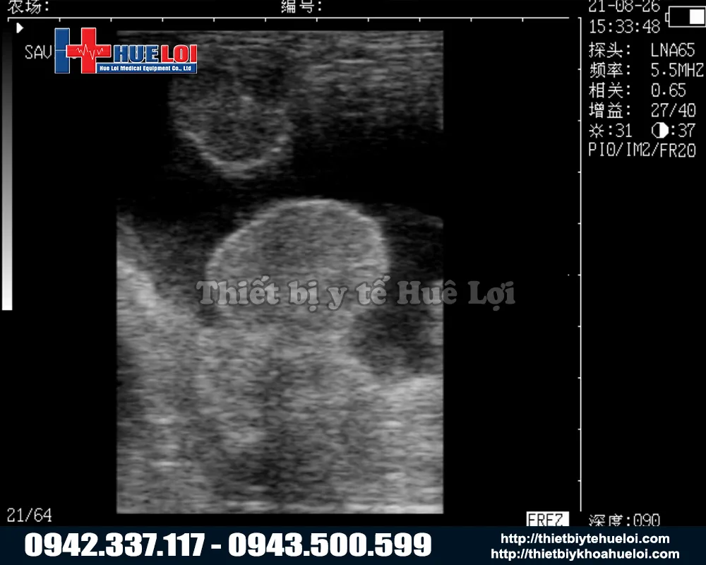 Hình ảnh của máy siêu âm trang trại