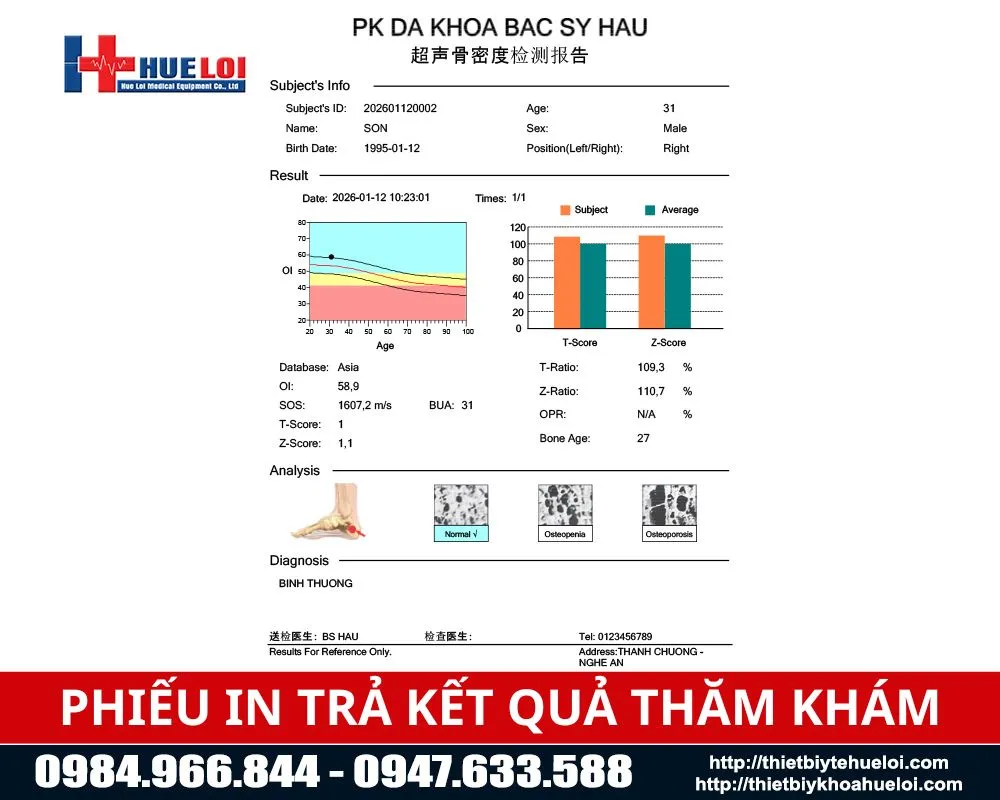 Phiếu trả kết quả của máy đo loãng xương gót chân