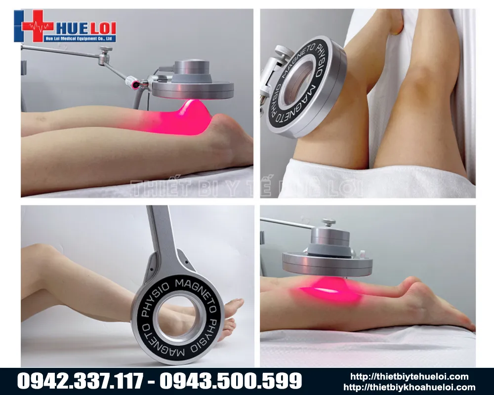 các vùng điều trị của máy từ trường