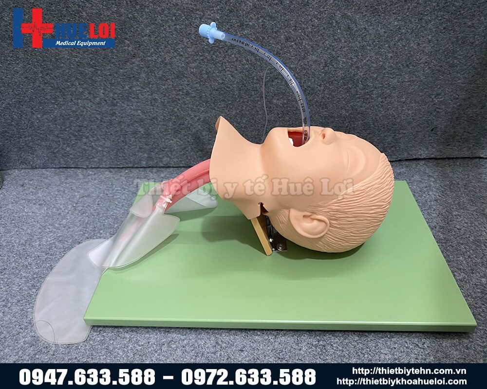 đặt nội khí quản lý trẻ em