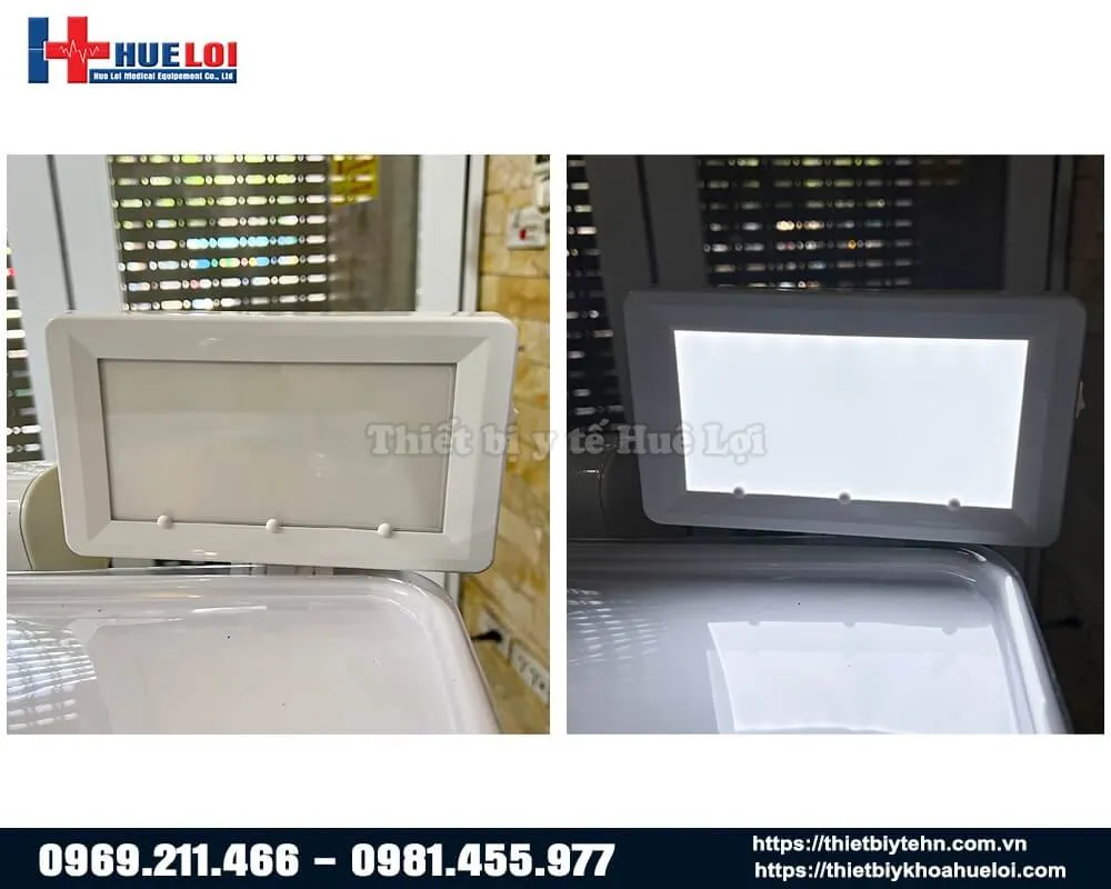 đèn đọc phim x quang ghế nha khoa điện giá rẻ đèn đọc phim x quang ghế nha khoa điện giá rẻ