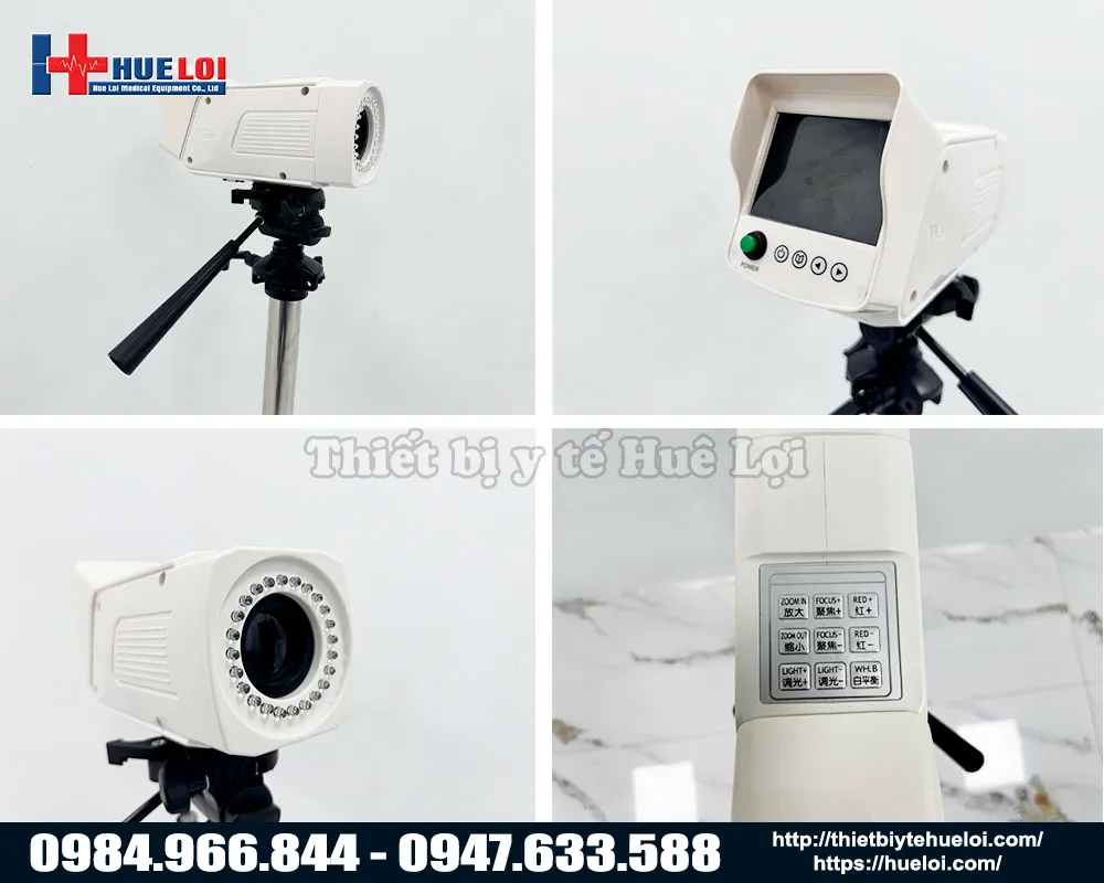 Máy soi cổ tử cung có màn hình sau sanwe sw304