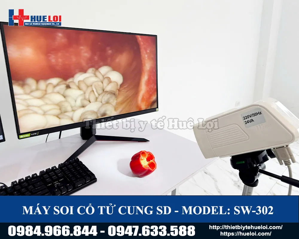 Hình ảnh của máy soi cổ tử cung sw302