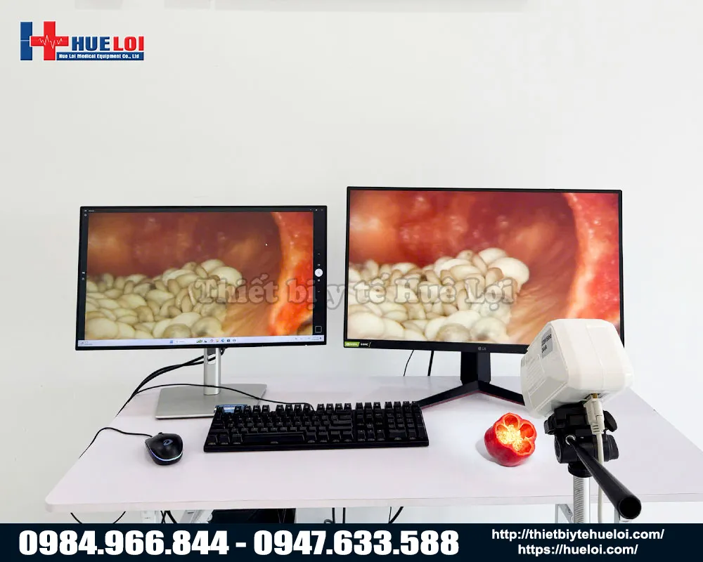 Chất lượng hình ảnh của máy soi cổ tử cung sw302